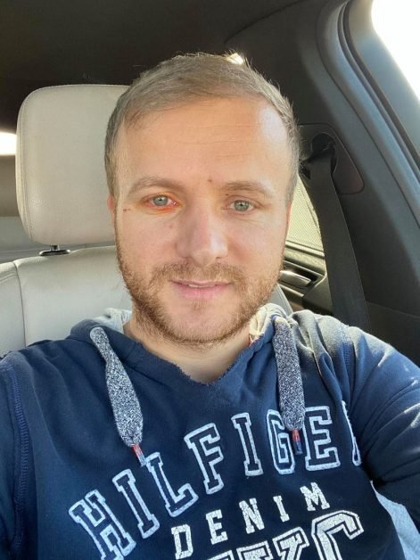 Cine este Daniel Bodnar, activistul de mediu aflat în stare gravă în urma unui accident rutier. Hoții de păduri l-au atacat de mai multe ori