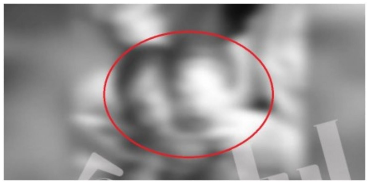 Caz rar în România. Bebeluş cu două capete, născut într-un spital din Bucureşti