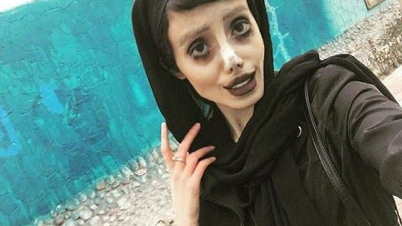 S-a operat de 50 ori ca să semene cu Angelina Jolie, însă arată ca un cadavru. Adolescenta care a uimit lumea
