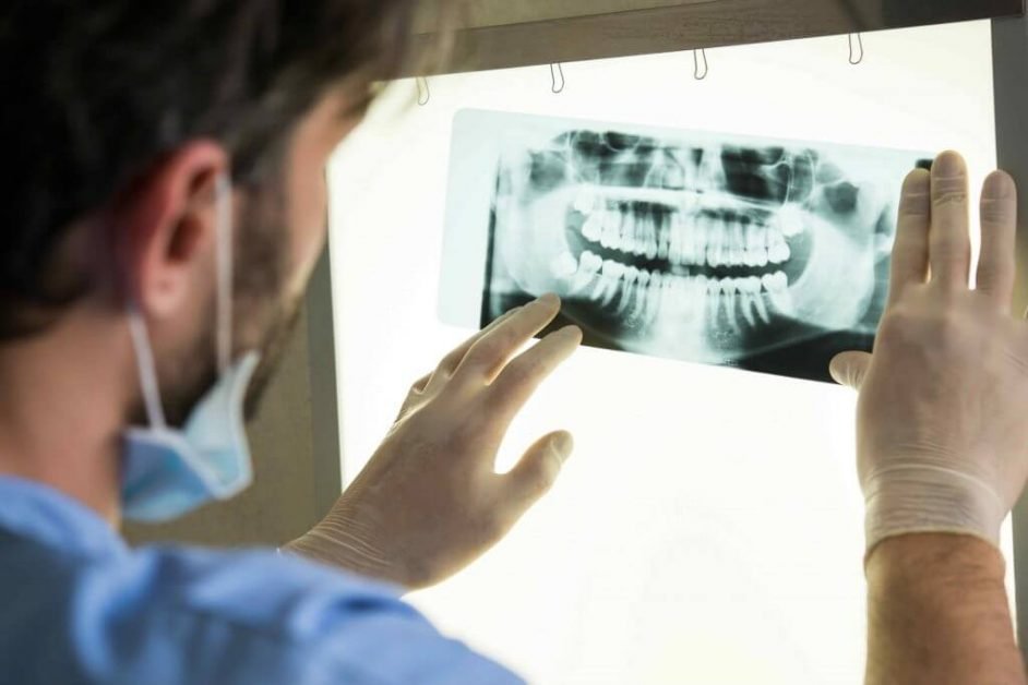 Peste 90 la suta din bolnavii de cancer au suferit aceasta interventie stomatologica inainte