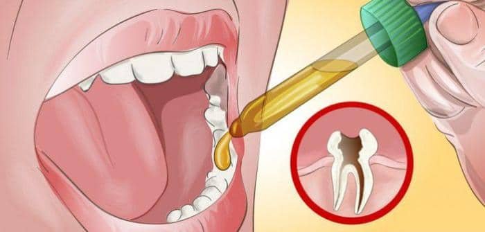 Cum scapi de durerea de măsea în 5 minute! Cu aceste leacuri numai ai nevoie de dentist!
