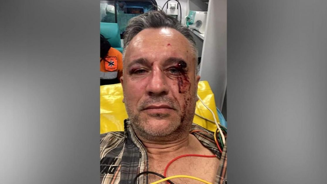 Doi jurnaliști și un activist care făceau pentru Greenpeace un film despre tăierile ilegale, bătuți crunt de 20 de indivizi într-o pădure din Suceava. Incredibil este abia ce a urmat